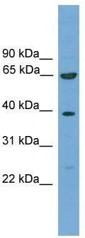 WB Suggested Anti-KLHL20 Antibody Titration: 0.2-1 ug/ml; ELISA Titer: 1: 1562500; Positive Control: Hela cell lysateThere is BioGPS gene expression data showing that KLHL20 is expressed in HeLa