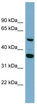 WB Suggested Anti-ADAMDEC1 Antibody Titration: 0.2-1 ug/ml; Positive Control: ACHN cell lysate