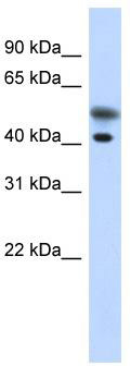 WB Suggested Anti-TMOD2 Antibody Titration: 0.2-1 ug/ml; ELISA Titer: 1: 62500; Positive Control: Transfected 293T