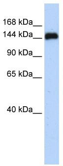 WB Suggested Anti-GSE1 Antibody Titration: 0.2-1 ug/ml; ELISA Titer: 1: 312500; Positive Control: 721_B cell lysate
