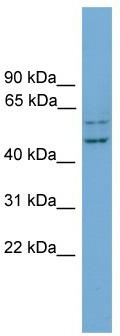 WB Suggested Anti-RAB11FIP2 Antibody Titration: 0.2-1 ug/ml; Positive Control: COLO205 cell lysate