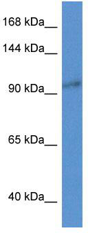 WB Suggested Anti-Zc3h3 Antibody; Titration: 1.0 ug/ml; Positive Control: Mouse Pancreas