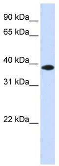 WB Suggested Anti-GPD1L Antibody Titration: 0.2-1 ug/ml; ELISA Titer: 1: 312500; Positive Control: Human Muscle