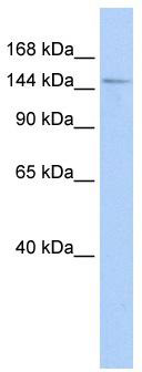WB Suggested Anti-HISPPD1 Antibody Titration: 0.2-1 ug/ml; ELISA Titer: 1: 1562500; Positive Control: Transfected 293T