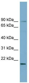 WB Suggested Anti-KIAA0776 Antibody Titration: 0.2-1 ug/ml; ELISA Titer: 1: 312500; Positive Control: Human kidney