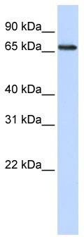 WB Suggested Anti-WDSOF1 Antibody Titration: 0.2-1 ug/ml; ELISA Titer: 1: 312500; Positive Control: HepG2 cell lysate