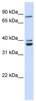WB Suggested Anti-C18orf10 Antibody Titration: 0.2-1 ug/ml; ELISA Titer: 1: 62500; Positive Control: 293T cell lysateTPGS2 is strongly supported by BioGPS gene expression data to be expressed in Human HEK293T cells