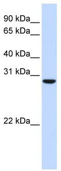 WB Suggested Anti-C18orf10 Antibody Titration: 0.2-1 ug/ml; ELISA Titer: 1: 62500; Positive Control: Human Muscle