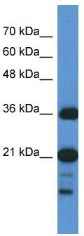 Typical titration curve of VIP in a competitive ELISA with the antibody from rabbit host