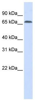 Typical titration curve of Adrenocorticotropic Hormone (1-39) in a competitive ELISA with this antibody