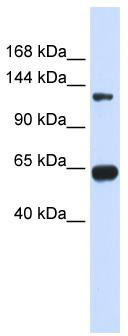 WB Suggested Anti-RGS22 Antibody Titration: 0.2-1 ug/ml; ELISA Titer: 1: 312500; Positive Control: Transfected 293T