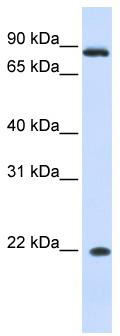 WB Suggested Anti-IFNA7 Antibody Titration: 0.2-1 ug/ml; ELISA Titer: 1: 312500; Positive Control: Human Liver