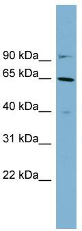 Typical titration curve of Octreotide in a competitive ELISA with this antibody