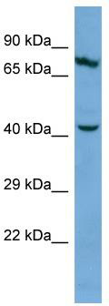 Host: Rabbit; Target Name: KRT83; Sample Tissue: COLO205 Whole Cell lysates; Antibody Dilution: 1.0 ug/ml