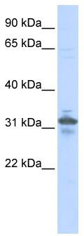 WB Suggested Anti-RPIA Antibody Titration: 0.2-1 ug/ml; ELISA Titer: 1: 62500; Positive Control: 293T cell lysateRPIA is supported by BioGPS gene expression data to be expressed in HEK293T