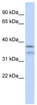 WB Suggested Anti-HYLS1 Antibody Titration: 0.2-1 ug/ml; ELISA Titer: 1: 62500; Positive Control: 293T cell lysate
