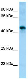 WB Suggested Anti-Sgms1 Antibody; Titration: 1.0 ug/ml; Positive Control: Mouse Muscle