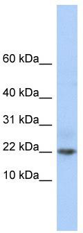 WB Suggested Anti-C9orf25 Antibody Titration: 0.2-1 ug/ml; ELISA Titer: 1:312500; Positive Control: Jurkat cell lysate