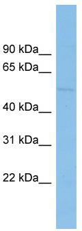 WB Suggested Anti-BEND7 Antibody Titration: 0.2-1 ug/ml; ELISA Titer: 1:62500; Positive Control: OVCAR-3 cell lysate