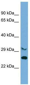 Host: Rabbit; Target Name: C10orf47; Sample Tissue: Jurkat Whole Cell lysates; Antibody Dilution: 1.0ug/ml