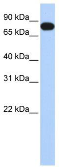 WB Suggested Anti-EML3 Antibody Titration: 0.2-1 ug/ml; ELISA Titer: 1:312500; Positive Control: Human Placenta