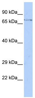 WB Suggested Anti-FBXW8 Antibody Titration: 0.2-1 ug/ml; ELISA Titer: 1:1562500; Positive Control: HepG2 cell lysate