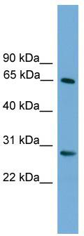 WB Suggested Anti-FBXW8 Antibody Titration: 0.2-1 ug/ml; Positive Control: ACHN cell lysate