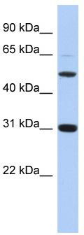 WB Suggested Anti-PI16 Antibody Titration: 0.2-1 ug/ml; ELISA Titer: 1:1562500; Positive Control: 721_B cell lysate