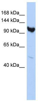WB Suggested Anti-ARMC3 Antibody Titration: 0.2-1 ug/ml; ELISA Titer: 1:1562500; Positive Control: HepG2 cell lysate
