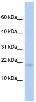 WB Suggested Anti-RFESD Antibody Titration: 0.2-1 ug/ml; ELISA Titer: 1:62500; Positive Control: Human brain