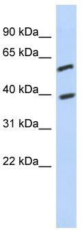 WB Suggested Anti-C6orf146 Antibody Titration: 0.2-1 ug/ml; ELISA Titer: 1:312500; Positive Control: Jurkat cell lysate