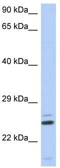 WB Suggested Anti-TTC9C Antibody Titration: 0.2-1 ug/ml; ELISA Titer: 1:1562500; Positive Control: Human Thymus