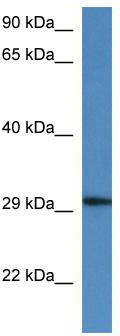 WB Suggested Anti-Harbi1 Antibody; Titration: 1.0 ug/ml; Positive Control: Mouse Kidney