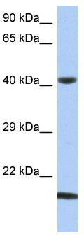 WB Suggested Anti-SEC14L4 Antibody Titration: 0.2-1 ug/ml; ELISA Titer: 1:1562500; Positive Control: OVCAR-3 cell lysate