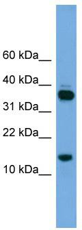 WB Suggested Anti-PRR15 Antibody Titration: 0.2-1 ug/ml; Positive Control: Jurkat cell lysate