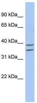 Typical titration curve of purified anti CNP in a competitive ELISA with this antibody. Procedure: antibody was applied to goat anti rabbit IgG-coated microtiter plate. tracer or tracer / antigen mixture was added, developed with streptavidin-HRPO and TMB as substrate for HRPO. Red curve: titration of antibody with CNP tracer (biotinylated peptide and streptavidin-HRPO). Blue curve: inhibition of tracer by antigen, showing affinity of antibody for CNP and tracer.