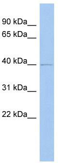 Typical titration curve of purified anti CNP in a competitive ELISA with this antibody. Procedure: antibody was applied to goat anti rabbit IgG-coated microtiter plate. tracer or tracer / antigen mixture was added, developed with streptavidin-HRPO and TMB as substrate for HRPO. Red curve: titration of antibody with CNP tracer (biotinylated peptide and streptavidin-HRPO). Blue curve: inhibition of tracer by antigen, showing affinity of antibody for CNP and tracer.