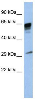 WB Suggested Anti-PRR18 Antibody Titration: 0.2-1 ug/ml; ELISA Titer: 1:312500; Positive Control: Human Placenta