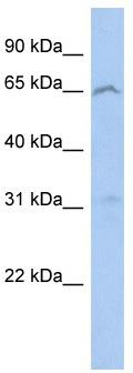 WB Suggested Anti-EFHA2 Antibody Titration: 0.2-1 ug/ml; ELISA Titer: 1:1562500; Positive Control: 293T cell lysate