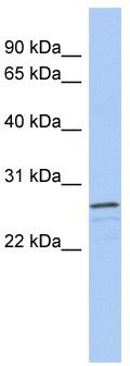 WB Suggested Anti-VSTM2A Antibody Titration: 0.2-1 ug/ml; ELISA Titer: 1:312500; Positive Control: Human brain