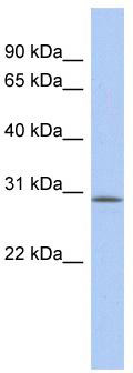 WB Suggested Anti-VSTM2A Antibody Titration: 0.2-1 ug/ml; ELISA Titer: 1:312500; Positive Control: Human Muscle