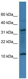 WB Suggested Anti-C14orf177 Antibody Titration: 0.2-1 ug/ml; ELISA Titer: 1:312500; Positive Control: 721_B cell lysate