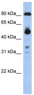 WB Suggested Anti-CCDC144B Antibody Titration: 0.2-1 ug/ml; ELISA Titer: 1:1562500; Positive Control: 293T cell lysate