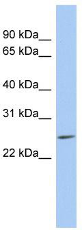 WB Suggested Anti-LYPD5 Antibody Titration: 0.2-1 ug/ml; ELISA Titer: 1:312500; Positive Control: MCF7 cell lysate