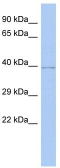 WB Suggested Anti-WDR53 Antibody Titration: 0.2-1 ug/ml; ELISA Titer: 1:1562500; Positive Control: Human brain