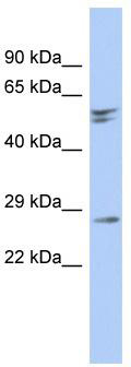 WB Suggested Anti-RD3 Antibody Titration: 0.2-1 ug/ml; ELISA Titer: 1:1562500; Positive Control: Human brain