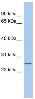 WB Suggested Anti-C11orf53 Antibody Titration: 0.2-1 ug/ml; ELISA Titer: 1:1562500; Positive Control: Hela cell lysate