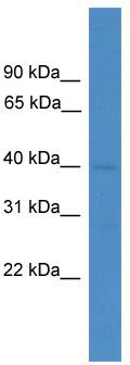 WB Suggested Anti-LANCL3 Antibody Titration: 0.2-1 ug/ml; ELISA Titer: 1:312500; Positive Control: ACHN cell lysate