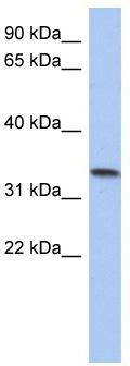WB Suggested Anti-C10orf96 Antibody Titration: 0.2-1 ug/ml; ELISA Titer: 1:312500; Positive Control: Human Placenta