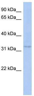 WB Suggested Anti-C10orf96 Antibody Titration: 0.2-1 ug/ml; ELISA Titer: 1:1562500; Positive Control: Human Placenta